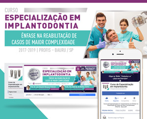 Social Media | Curso de Especialização em Implantodontia